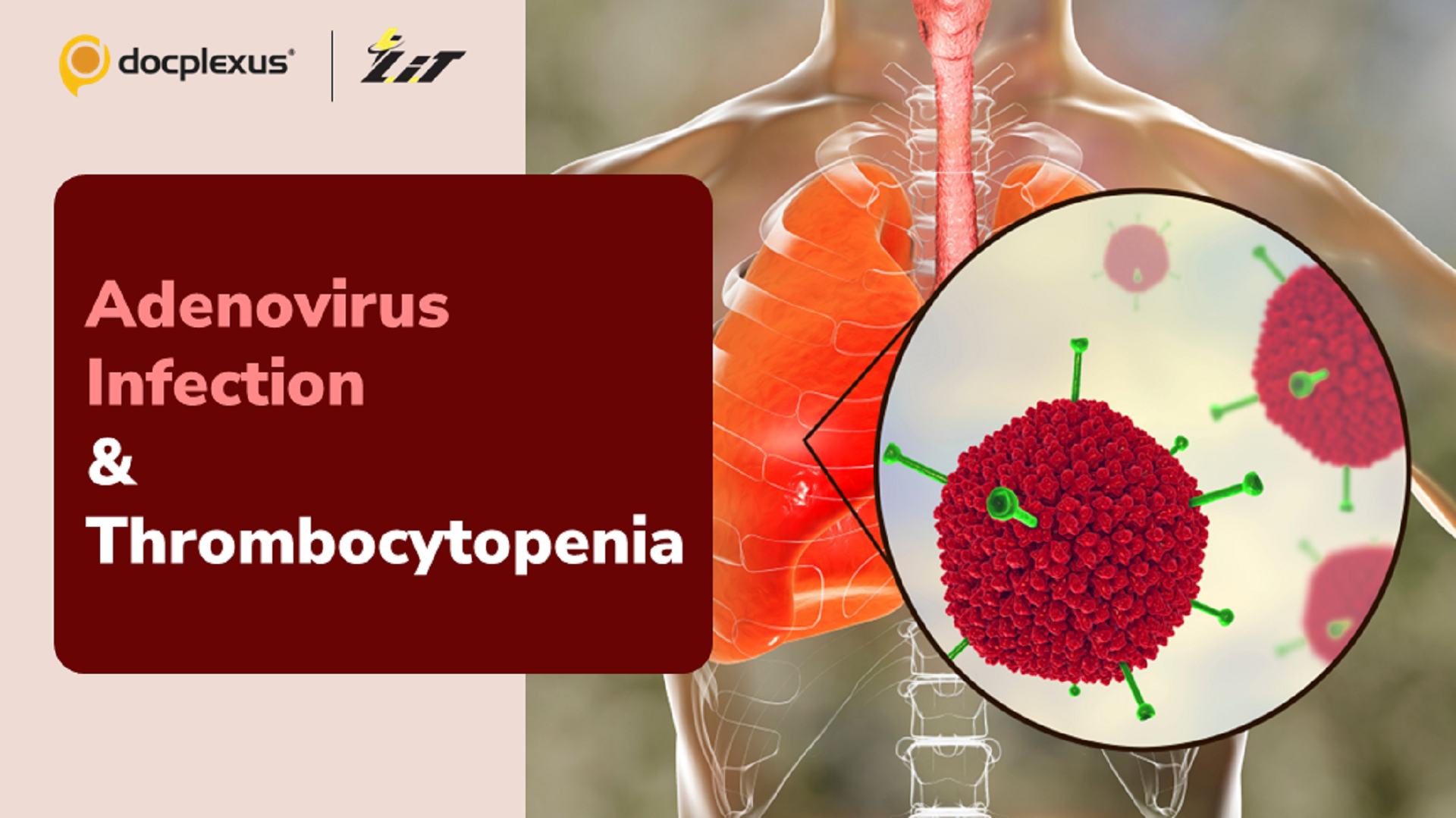 Can Adenovirus Infection Trigger Thrombosis?
