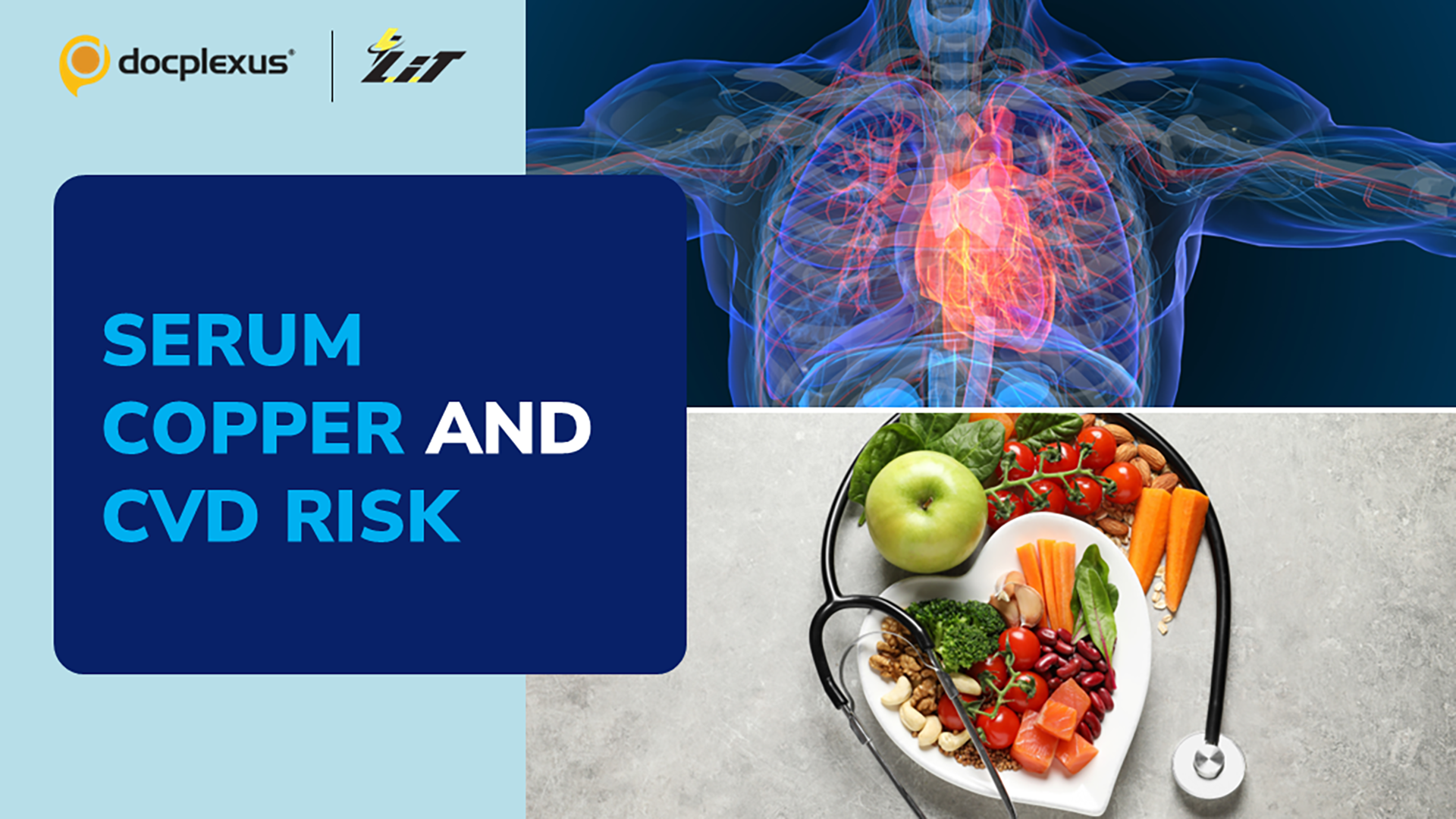 Is There an Association Between Serum Copper Levels and the Onset of CVD?