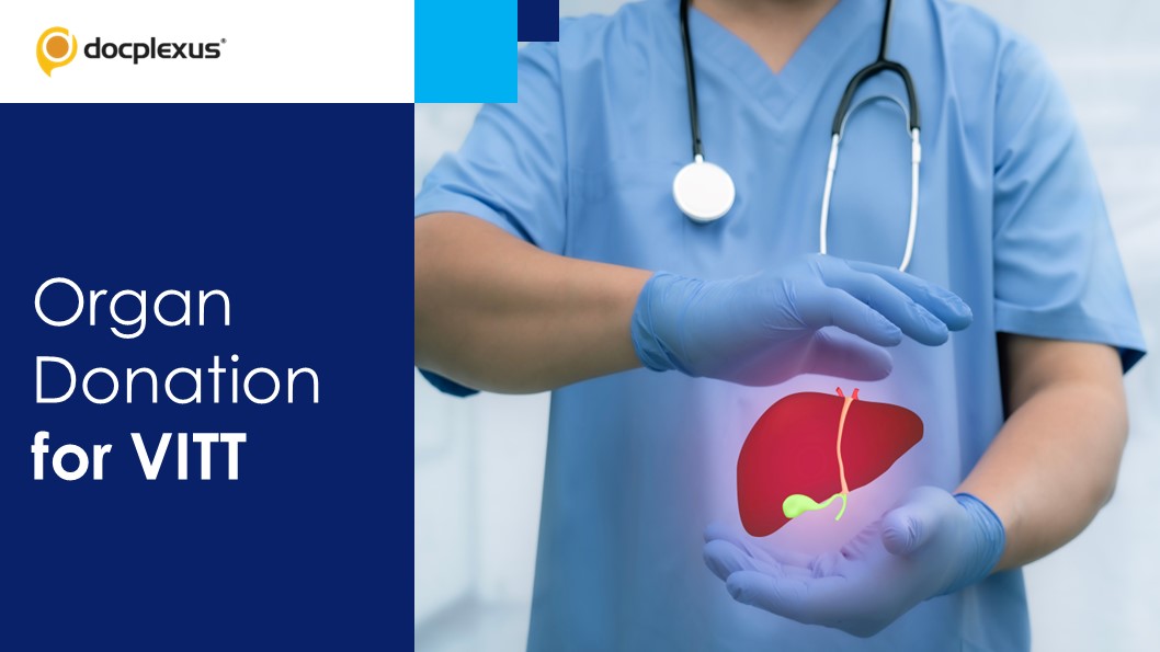 Vaccine-induced Thrombotic Thrombocytopenia in Organ Donation and Transplantation: NOTTO Guidelines (2023)