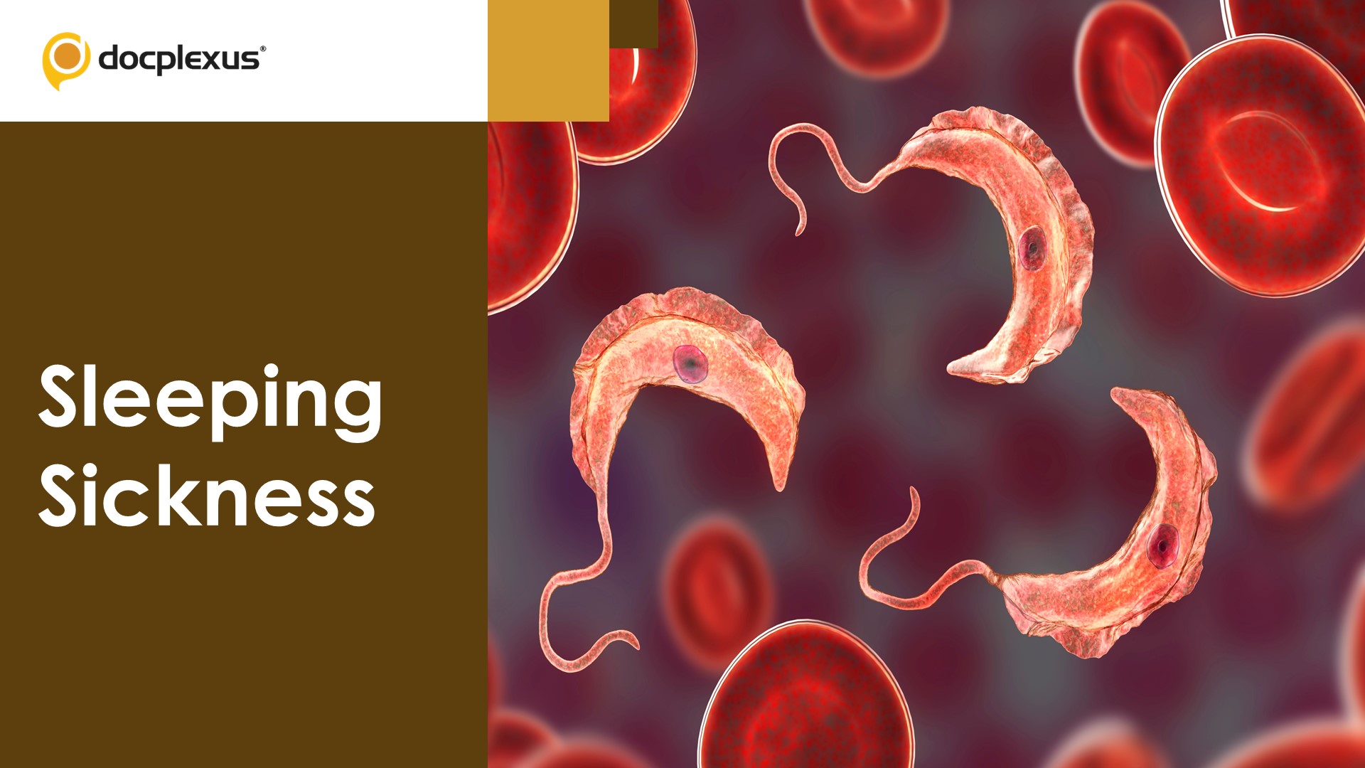 African Trypanosomiasis: How is it Diagnosed and Treated?
