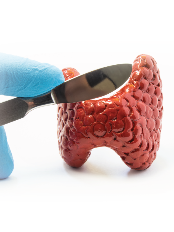 Robotic Thyroidectomy | Trismus Management for Oral Cancer