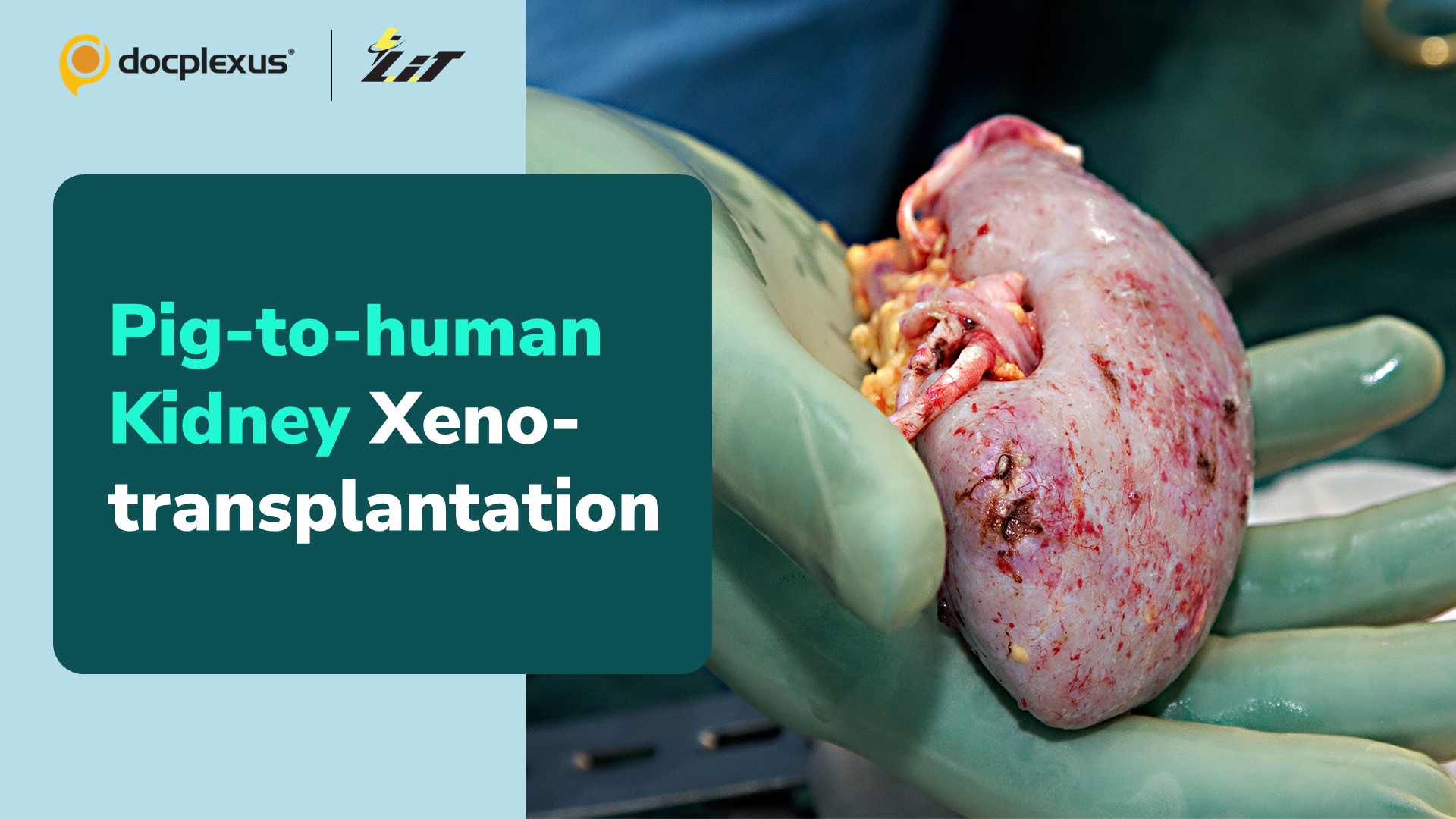Can Pigs' Kidneys Function Well in Humans?