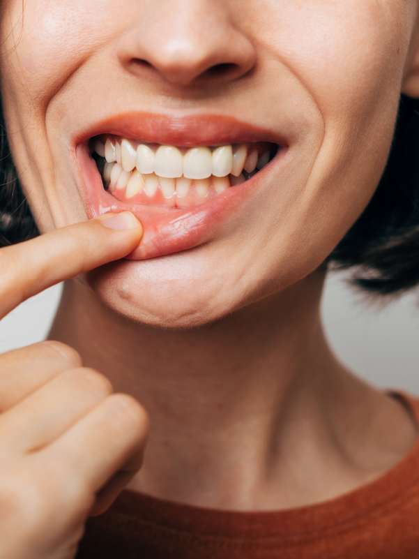 Periodontal Medicine