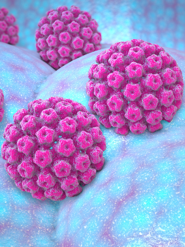 Oropharyngeal Cancer in the HPV-positive Era: Swinging the Pendulum Back to Surgery