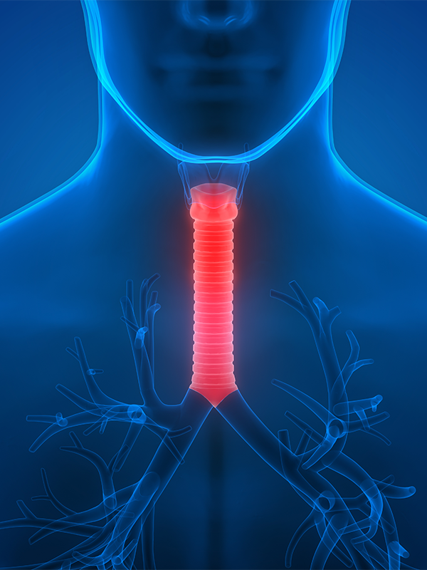 Surgical Management of Tracheal Tumors — Tips and Tricks