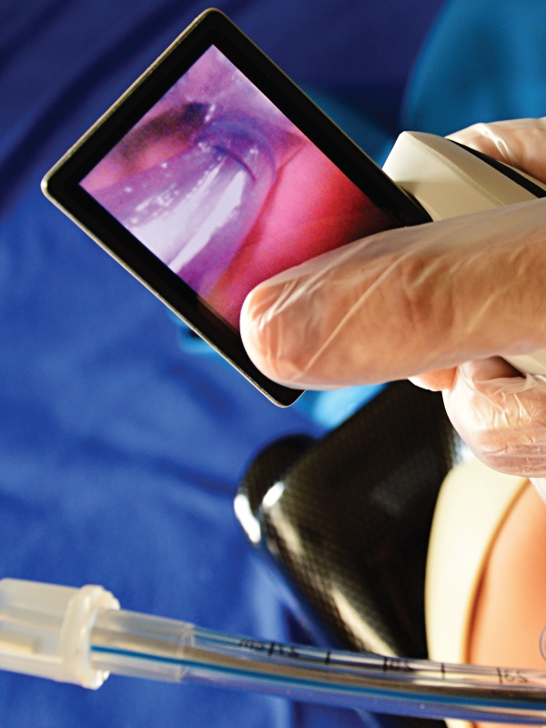Minimally Invasive Airway Procedure