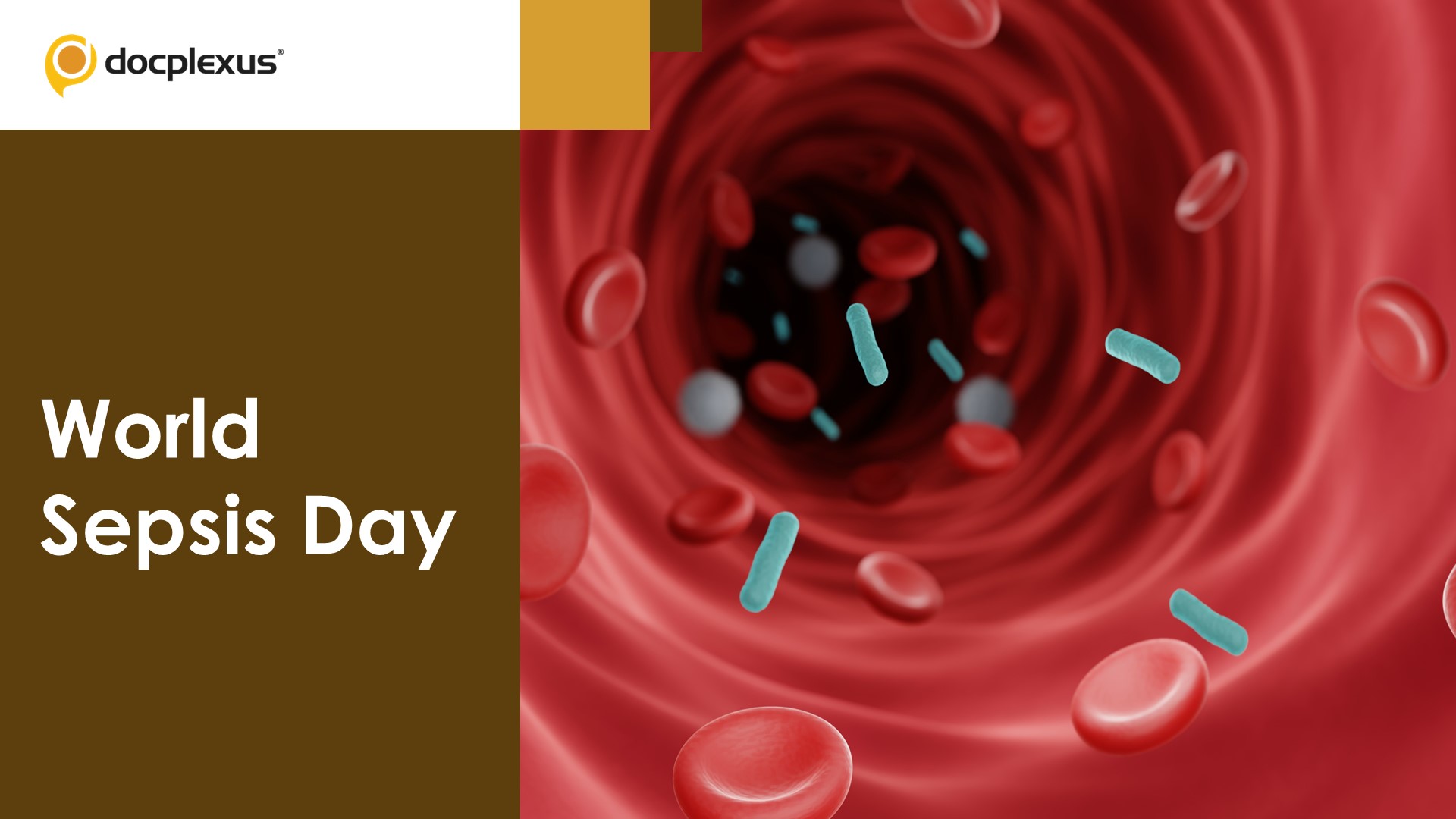 Debunking the Myths Regarding Sepsis
