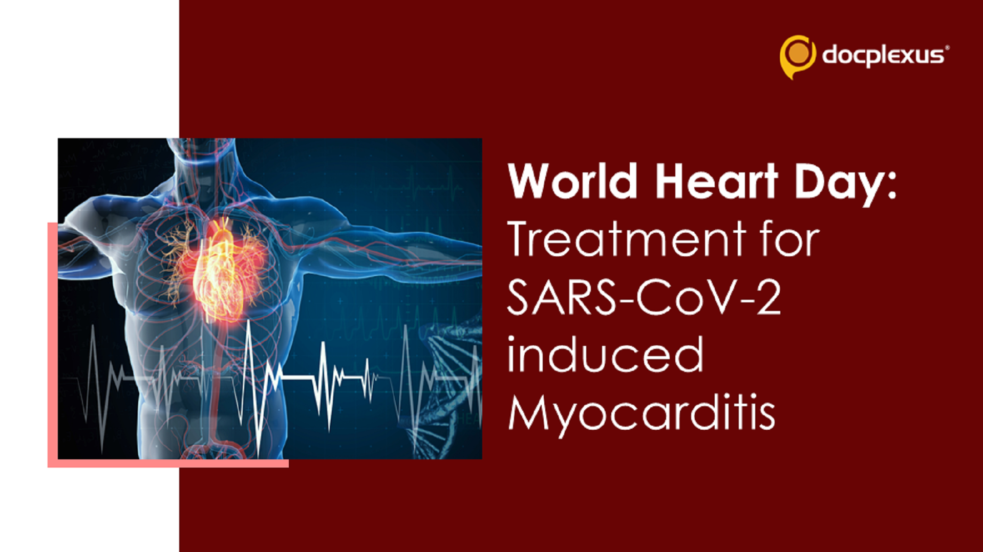 World Heart Day: Suggest Treatment for SARS-CoV-2-induced Myocarditis