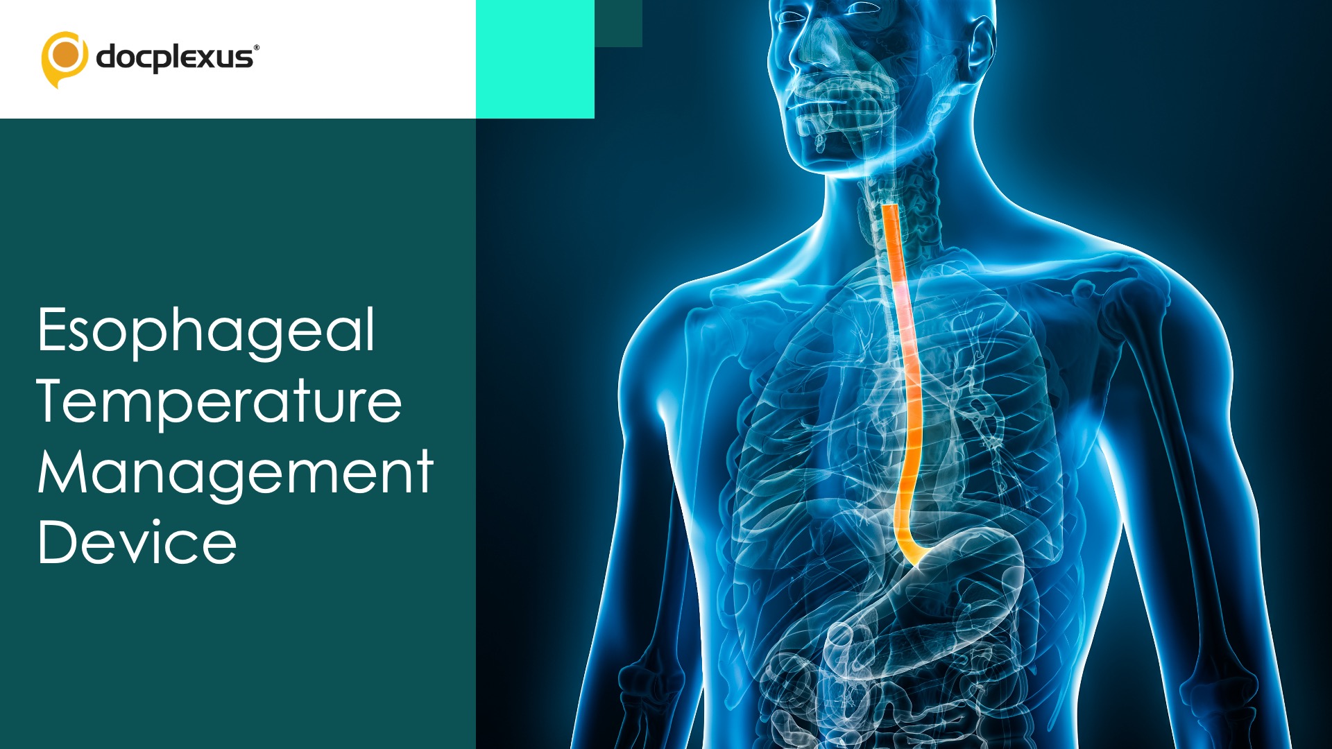 USFDA Approves Marketing of an Esophageal Temperature Management Device