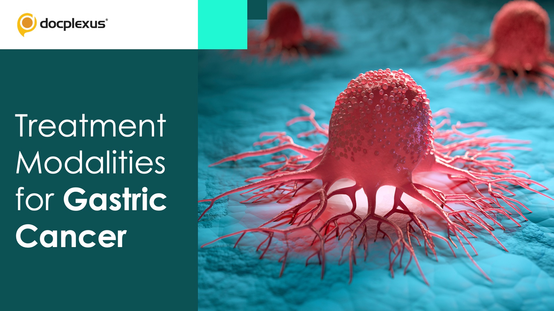 Treatment Modalities for Gastric Cancer