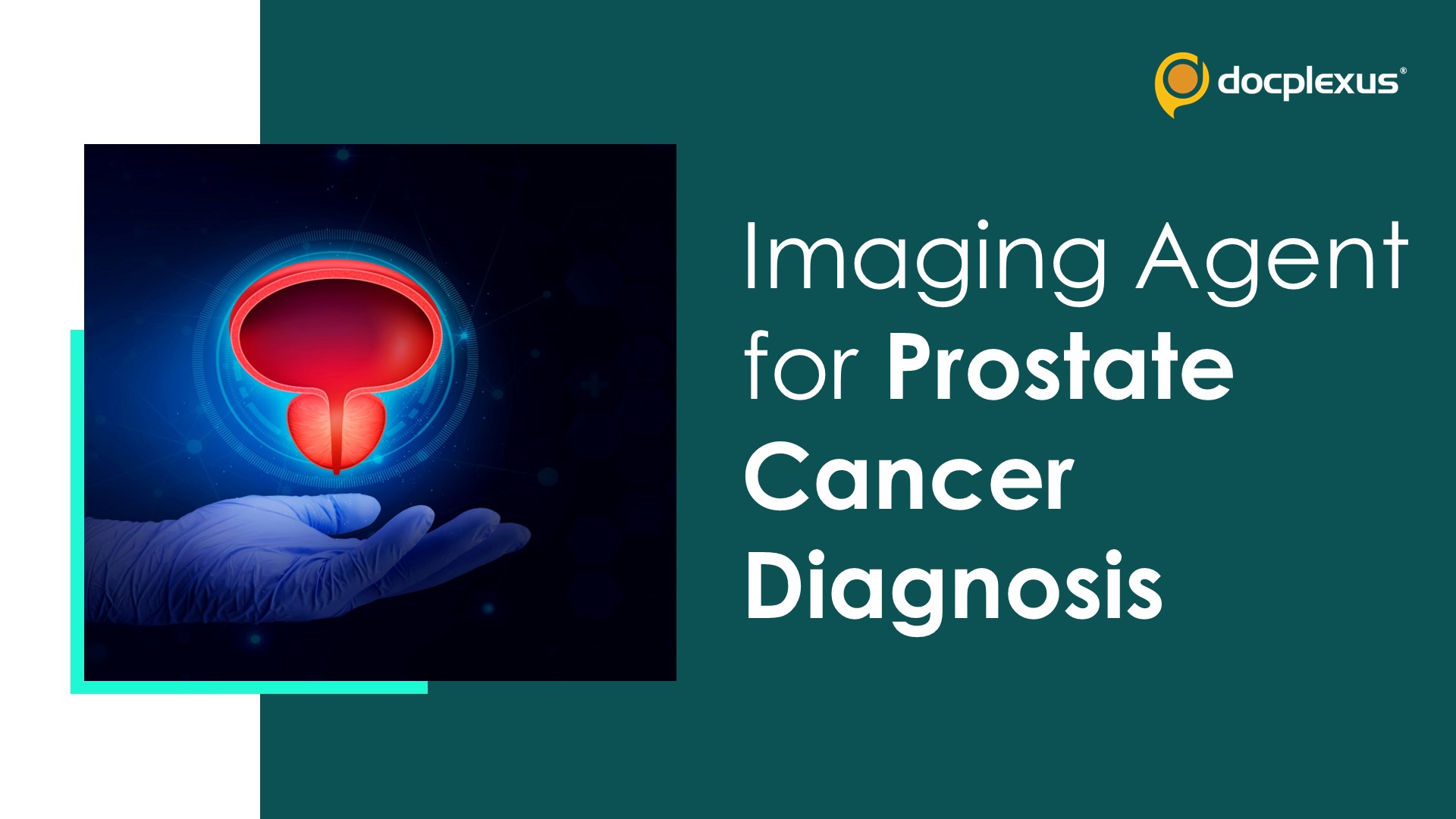 FDA Approves First Radiohybrid PSMA-targeted Imaging Agent for Prostate Cancer