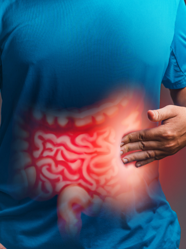 Colonic Polyp and Cancer