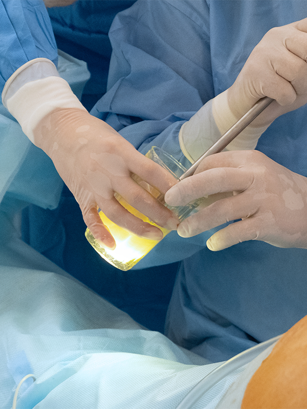 Laparoscopic Ventral Hernia Repair