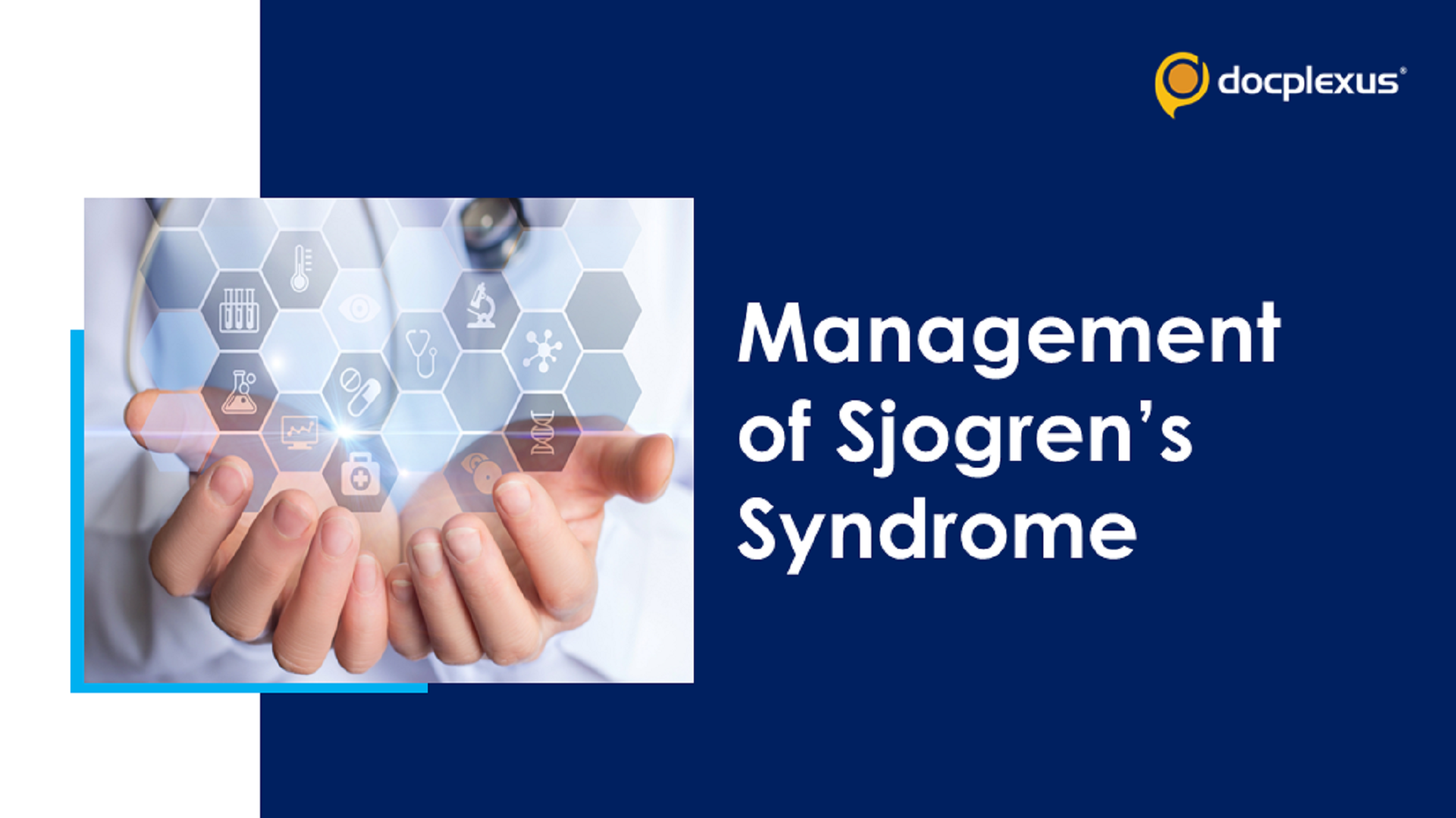 Management of Sjogren’s Syndrome