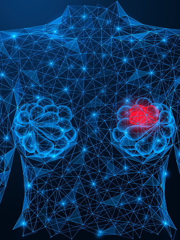 Phyllodes Tumors: Diagnosis, Management, and Therapeutic Updates