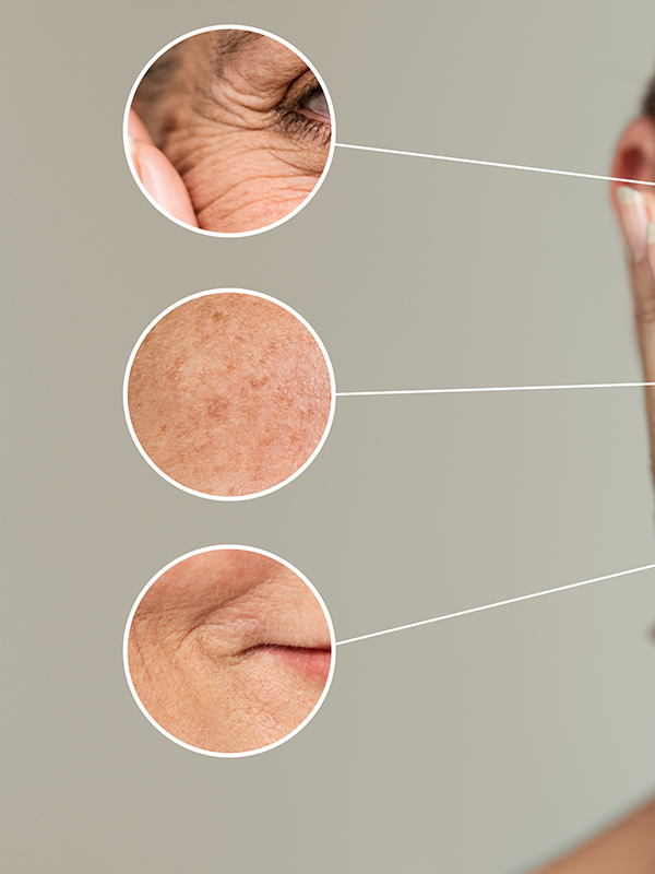 Interesting Cases in Dermatology