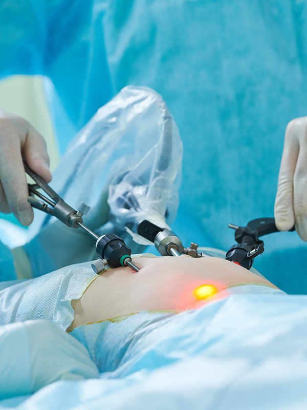 The Advantages of 3D Laparoscopy in Gynecology