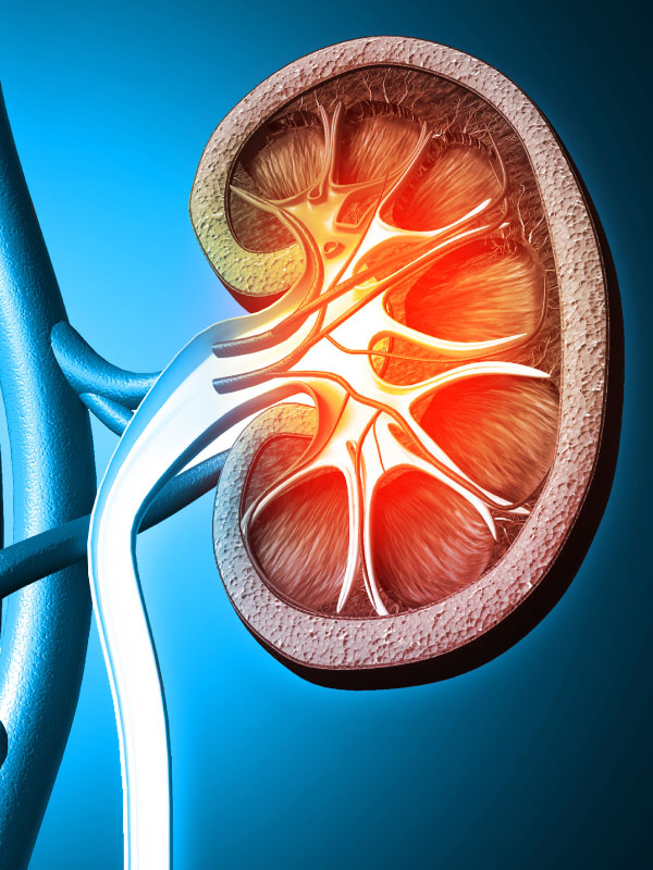 Understanding Chronic Kidney Disease