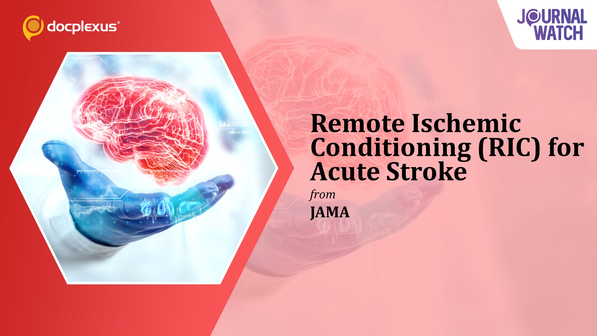 Does Combined Prehospital & In-hospital RIC Improve Acute Stroke Outcomes?