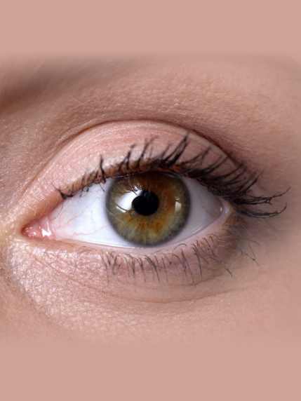 Dry Eye Syndrome — Causes, Symptoms, and Treatment