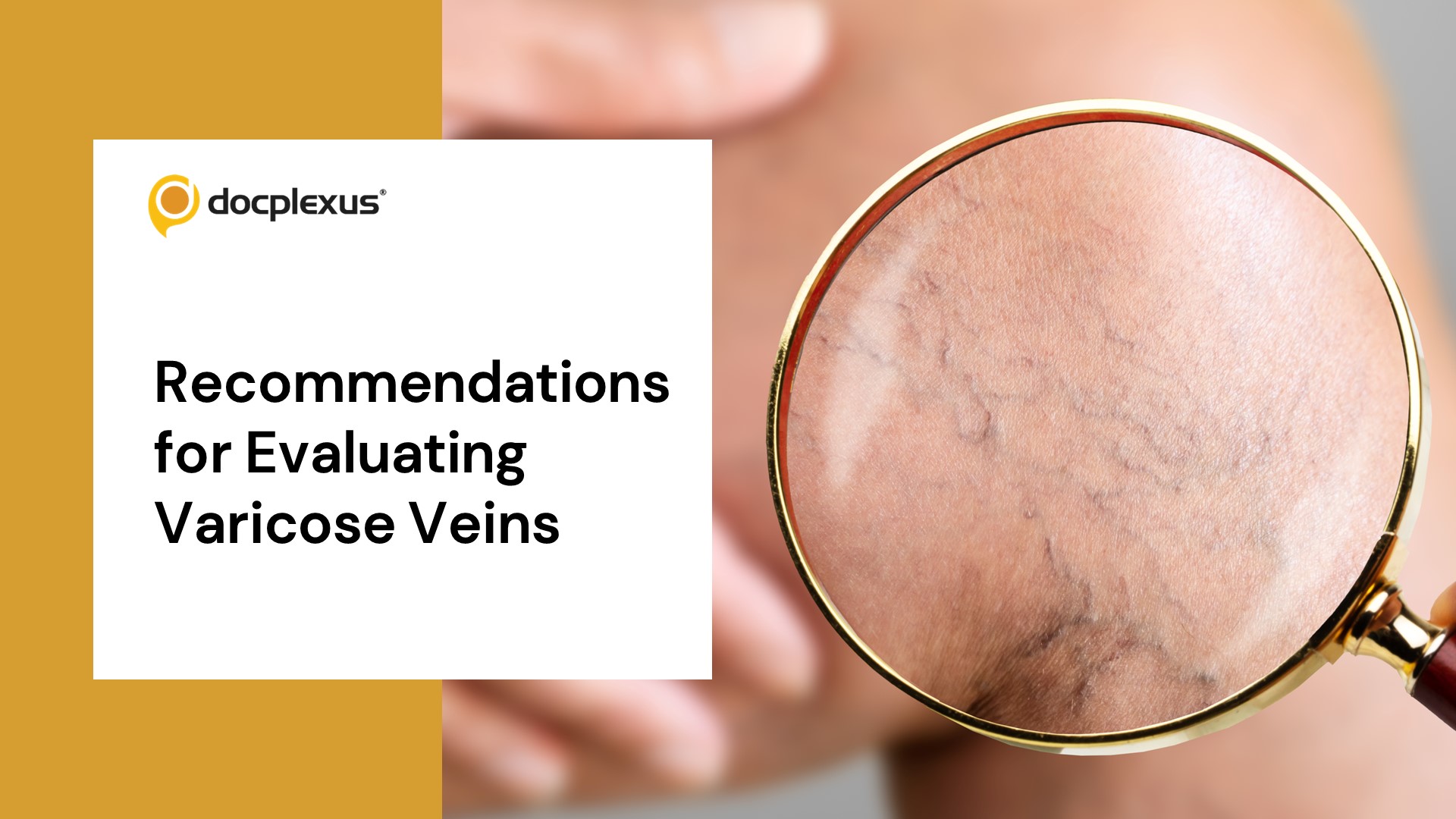 Varicose Veins of the Lower Extremities - Clinical Practice  Management Guidelines (2023)