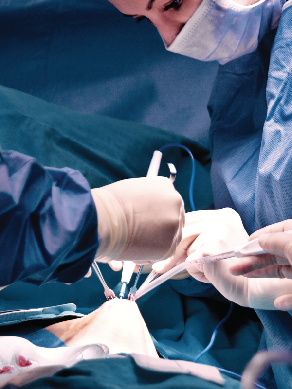Breast Reconstruction