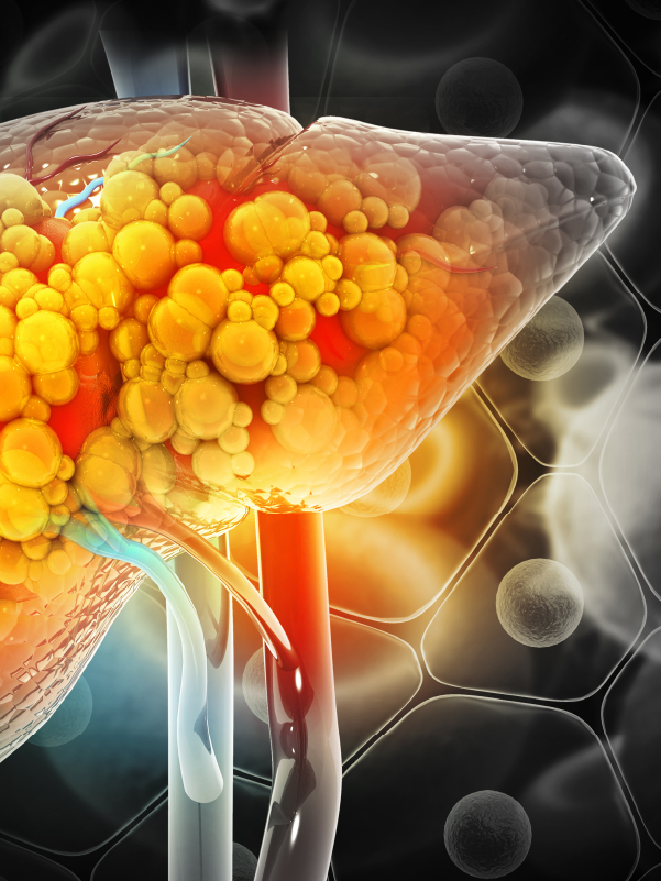 Drugs, Alcohol, and Lifestyle-induced Liver Diseases