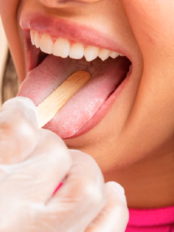Principles in Management of Primary Tumors of the Oral Cavity