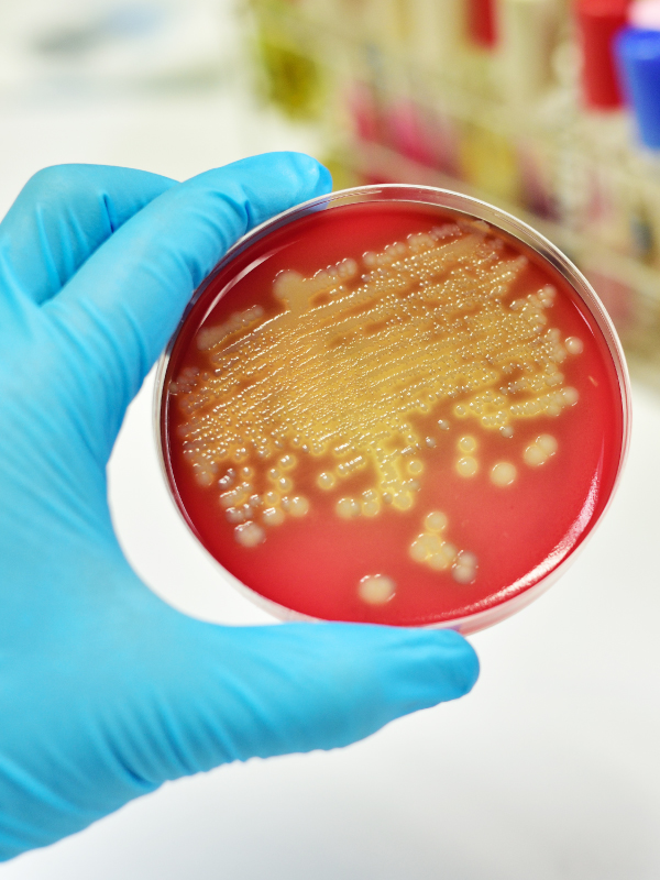 Clinical Parameters to Detect Sepsis