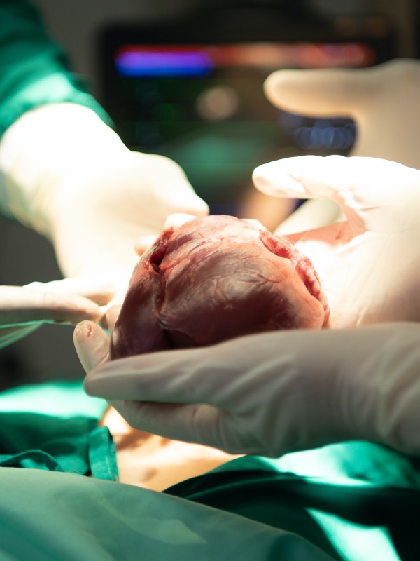 Infections in Solid Organ Transplant Recipient