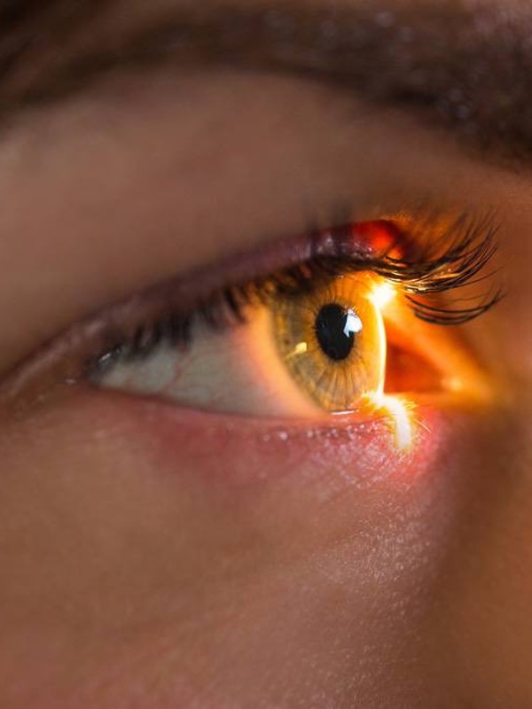 Dry Eye Workup – How to Apply DEWS 2?