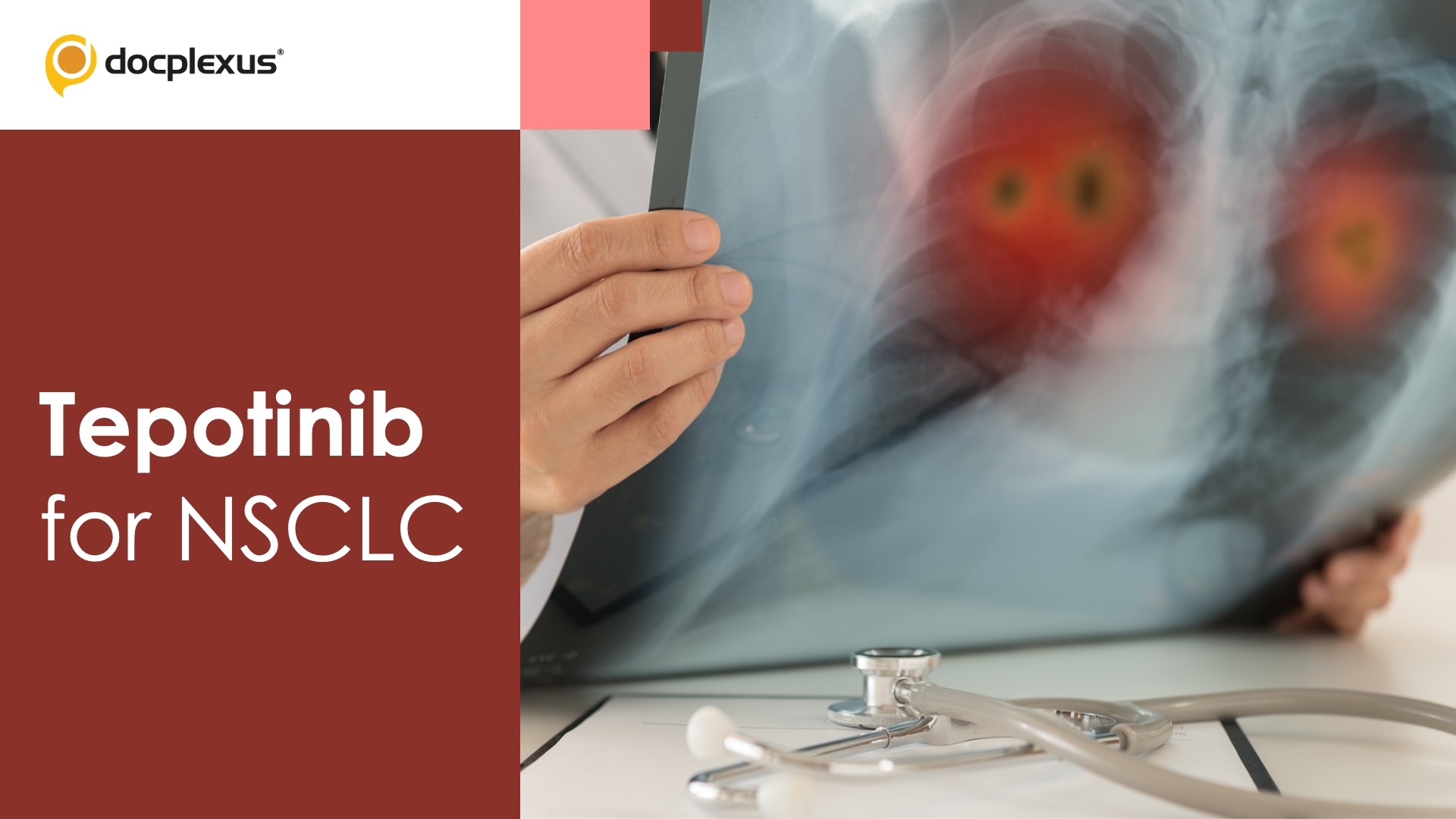 USFDA Approves Tepotinib for Metastatic NSCLC