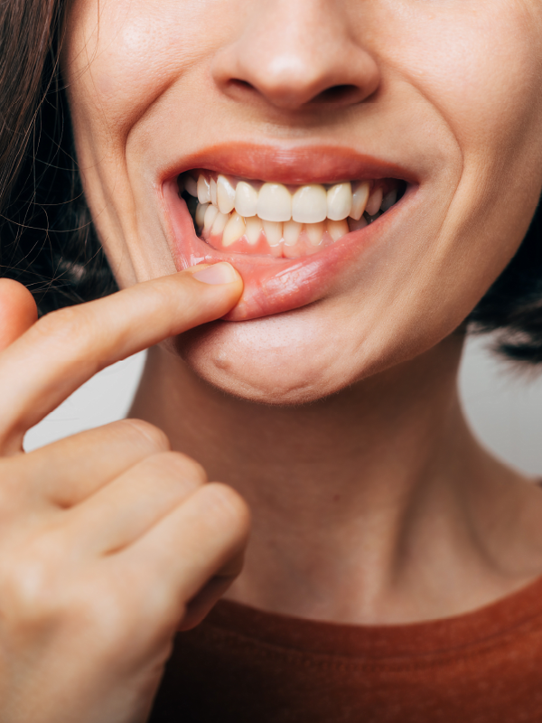 Periodontal Medicine