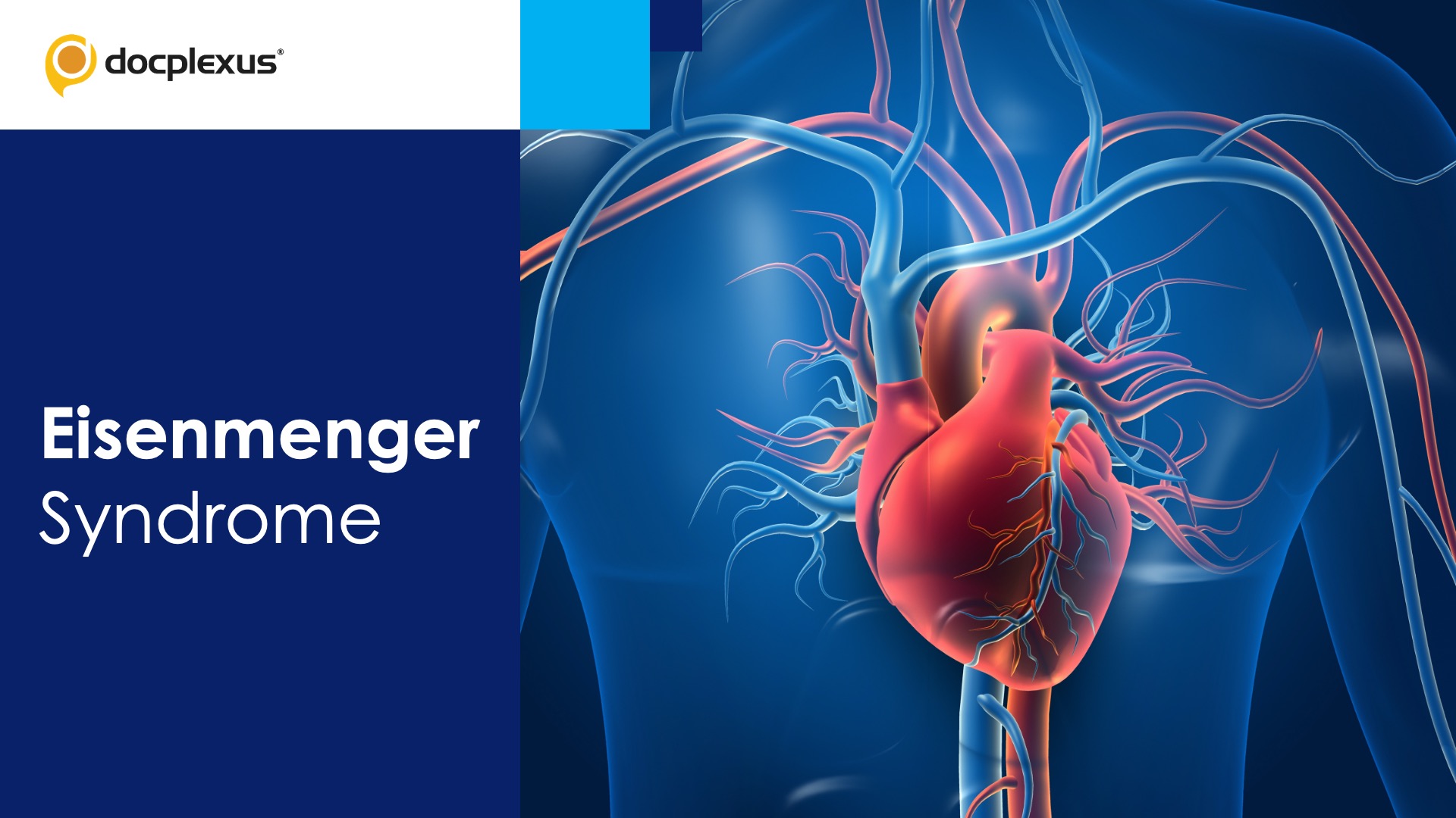 Eisenmenger Syndrome: Current Avenues in Classification and Treatment