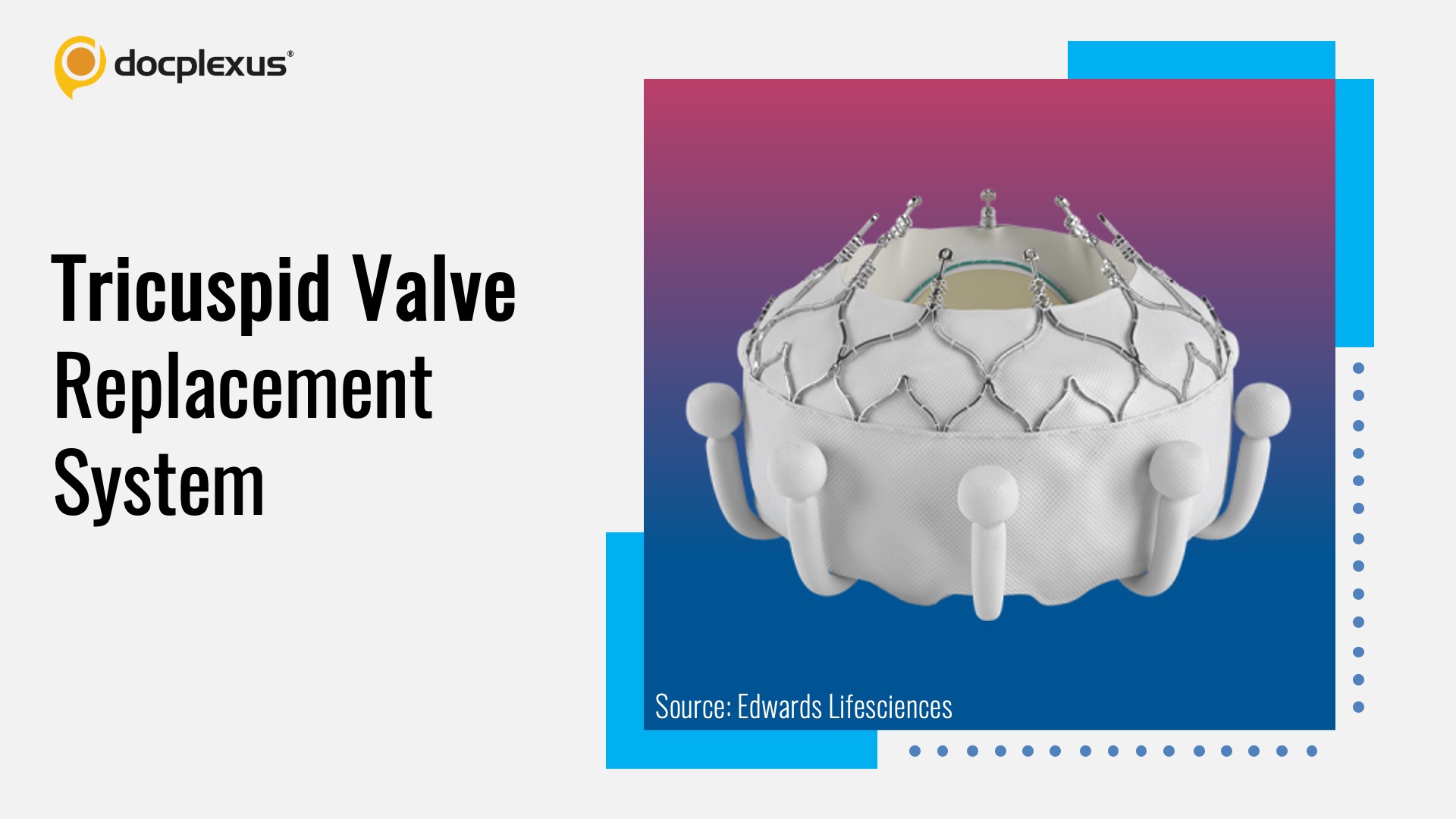 USFDA-approved Heart Valve for Tricuspid Regurgitation