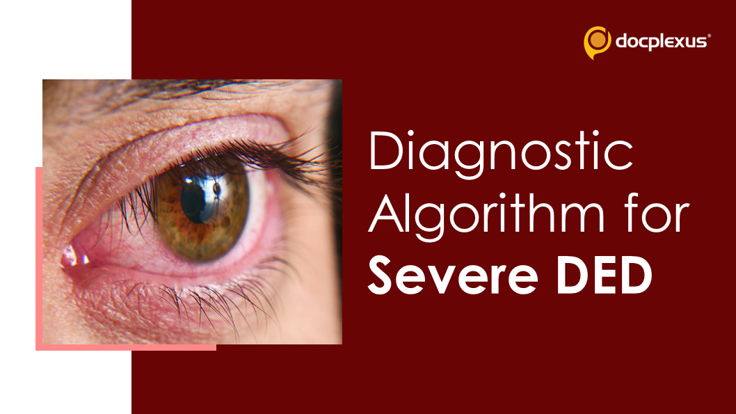 Recognizing the Risk Factors associated with DES