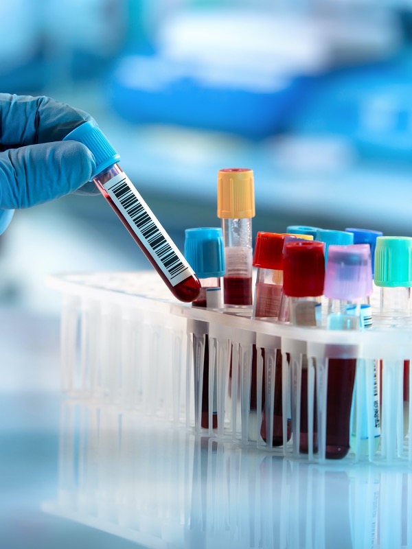 Unknown in Microbiology Labs and Reports
