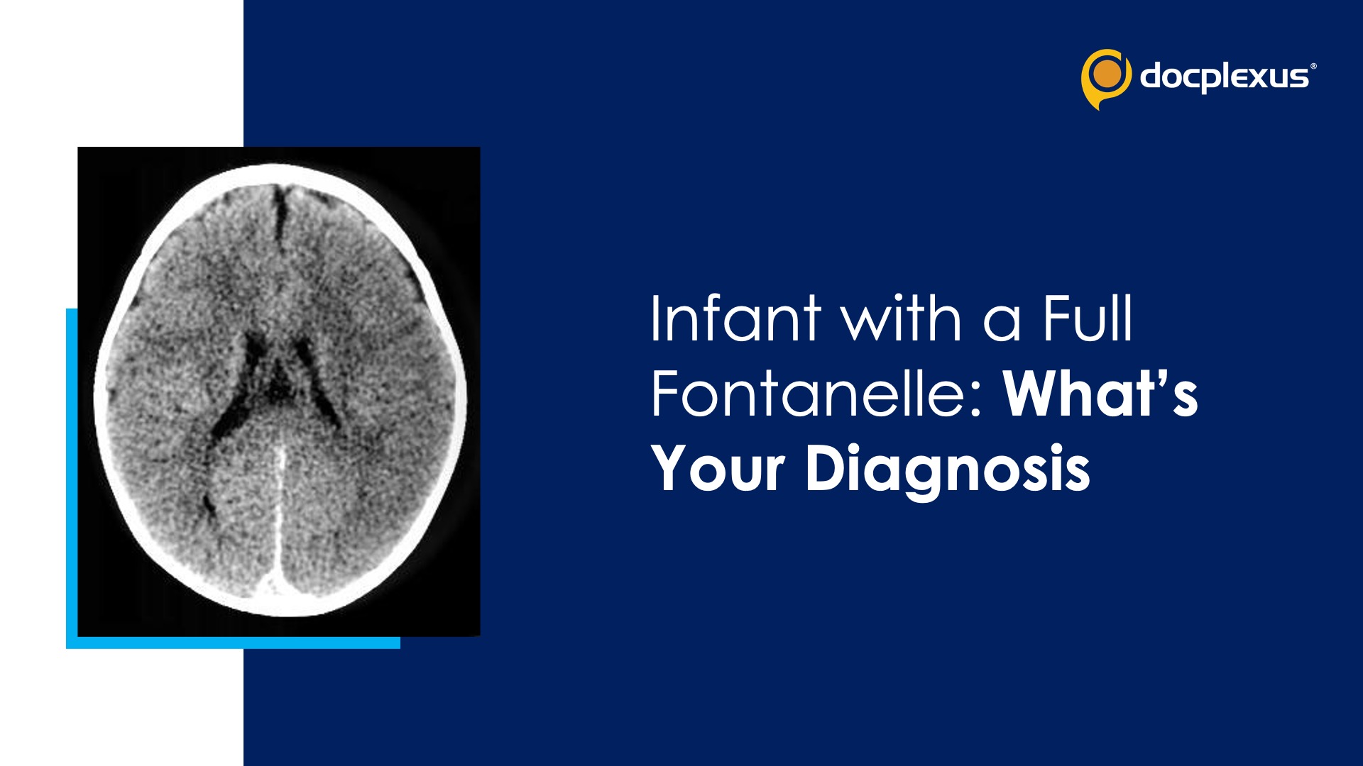 Infant with a Full Fontanelle: What's Your Diagnosis?