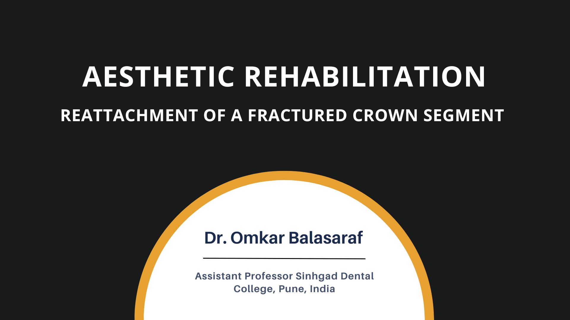 Aesthetic Rehabilitation: Reattachment of A Fractured  Crown Segment