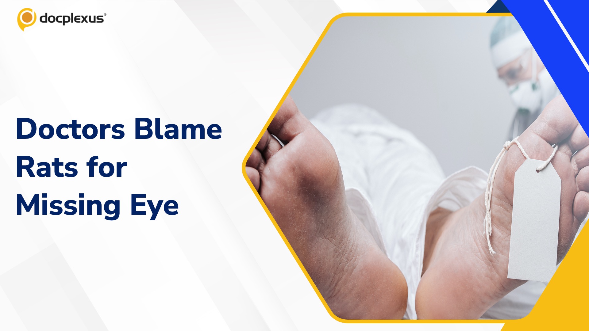 Doctors Cite Rats in Case of Missing Eye at Bihar Hospital