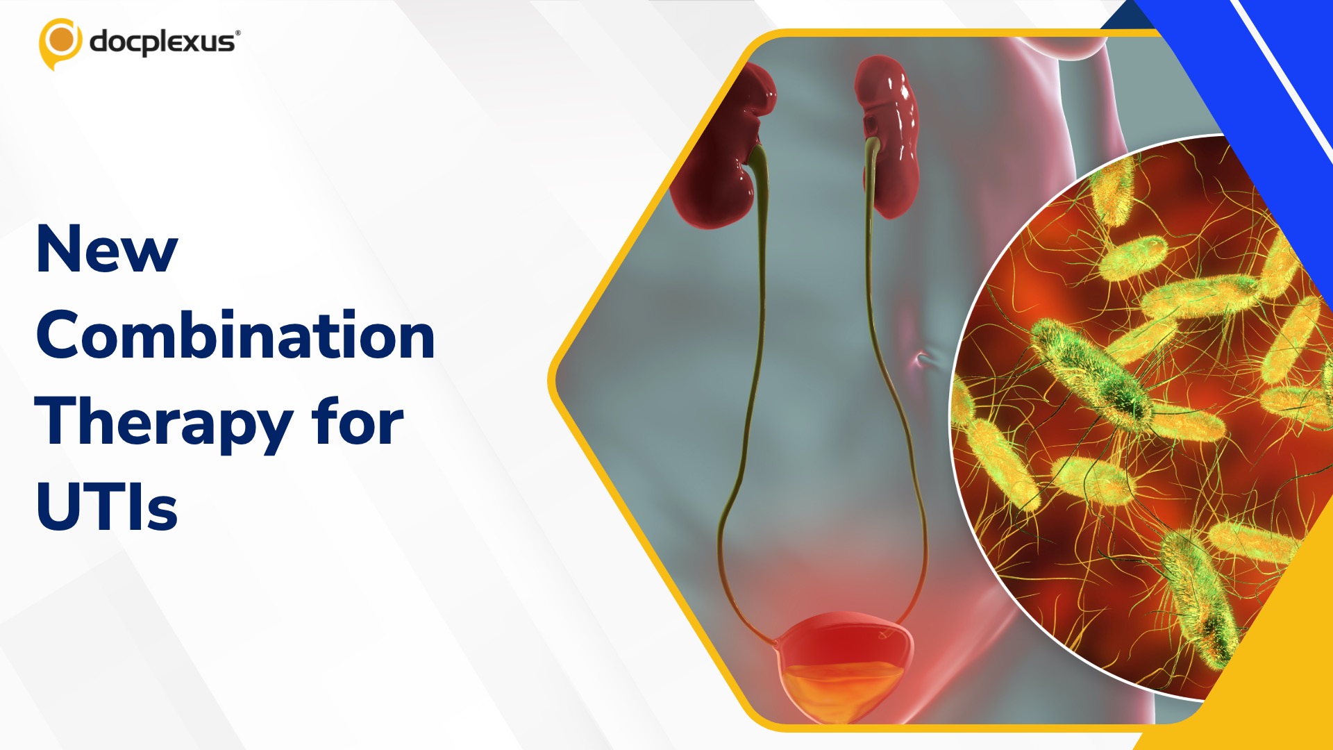 USFDA Approves Sulopenem Etzadroxil and Probenecid for Uncomplicated UTIs
