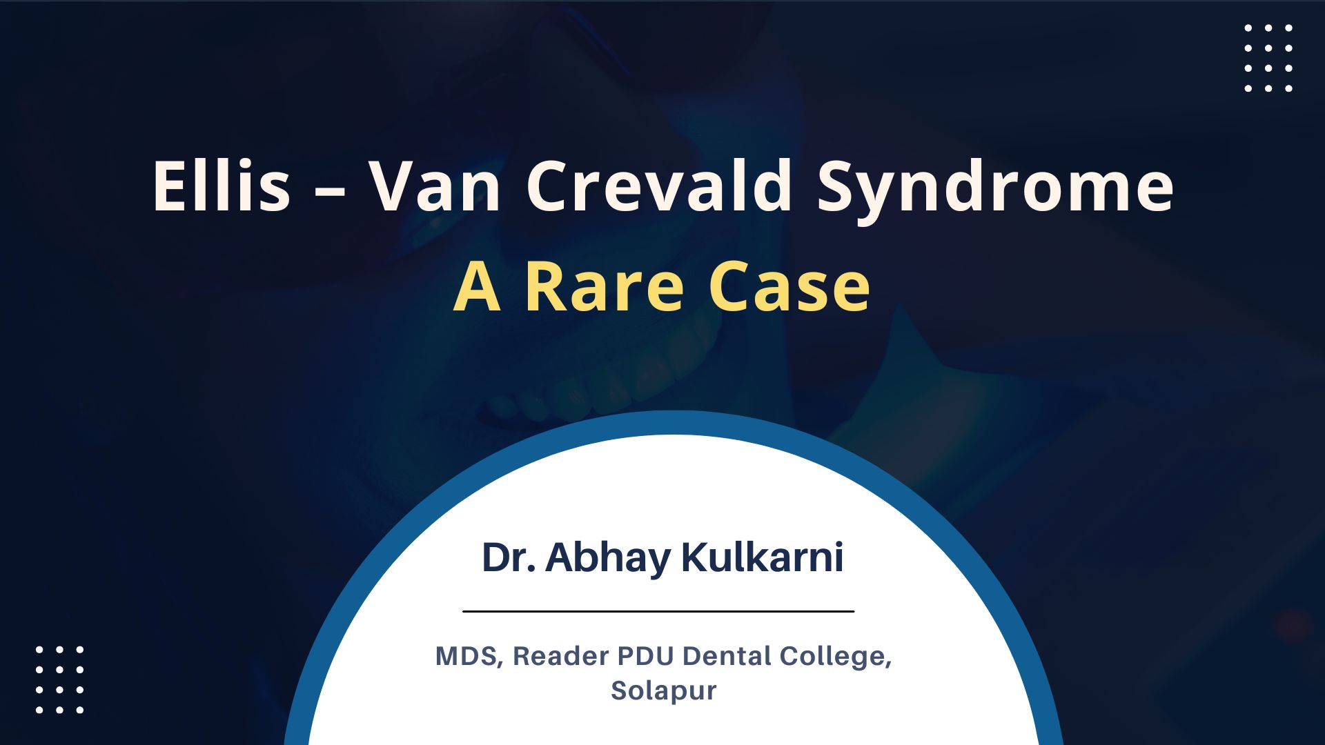 Ellis – Van Crevald Syndrome- A Rare Case