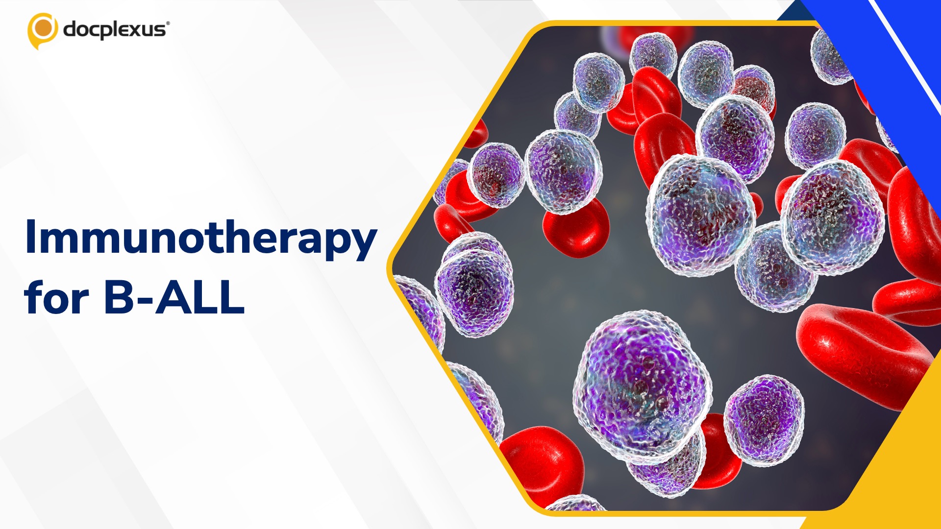 USFDA Approves Obecabtagene Autoleucel for B-cell Acute Lymphoblastic Leukemia