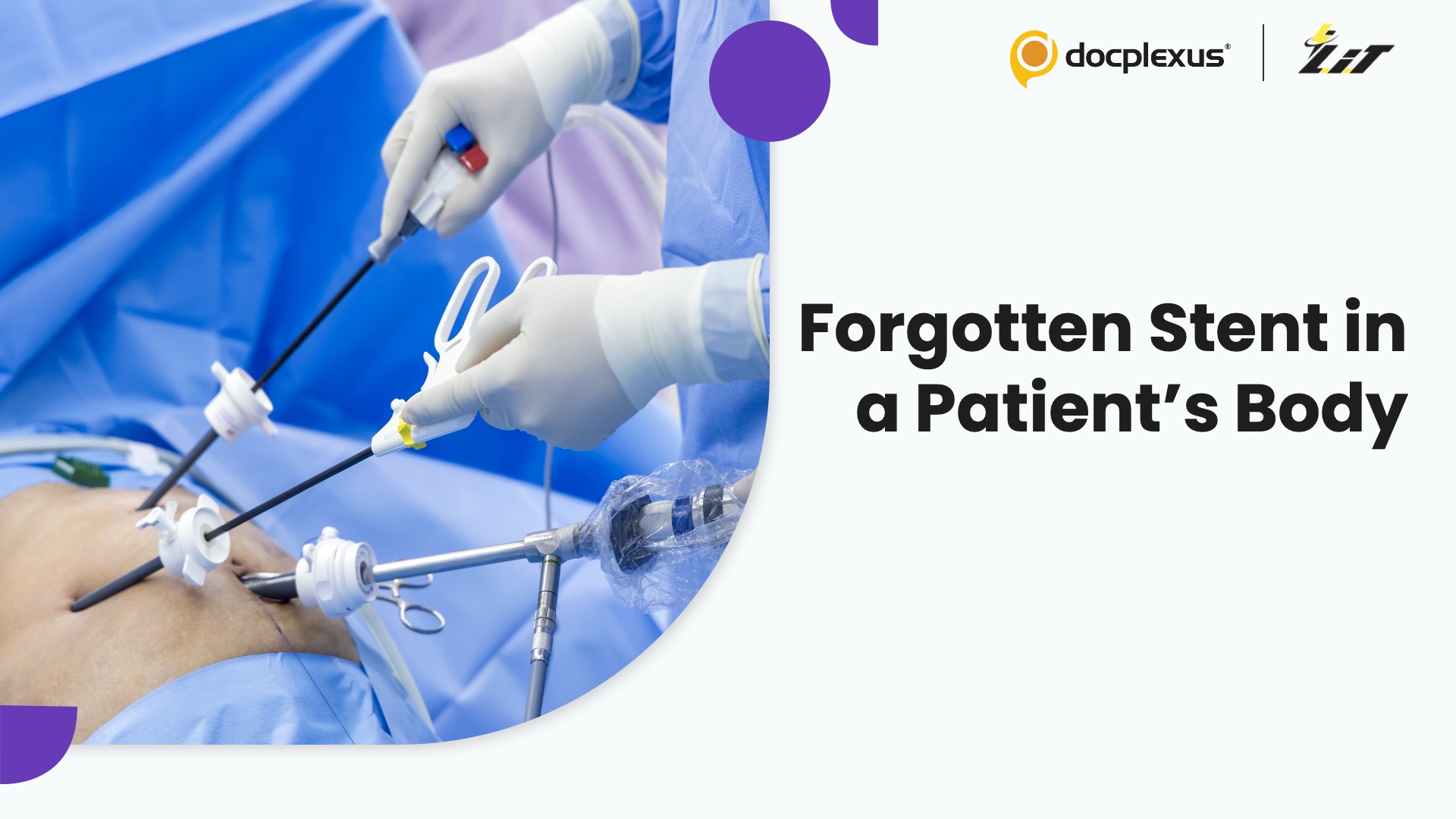 Surgeons Remove Forgotten Stent After Two Years
