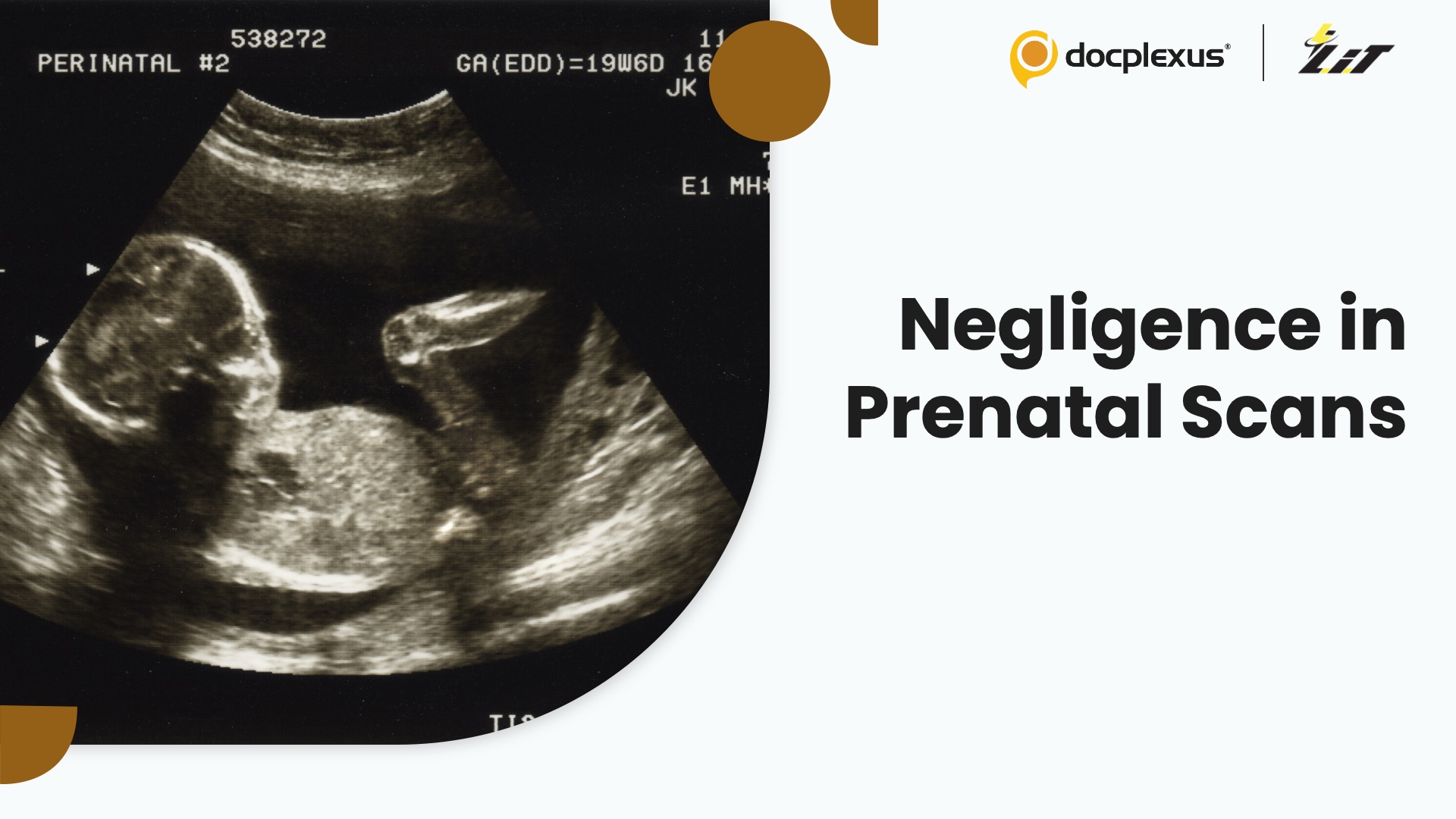 Police Book Four Doctors for Failing to Detect Birth Defects