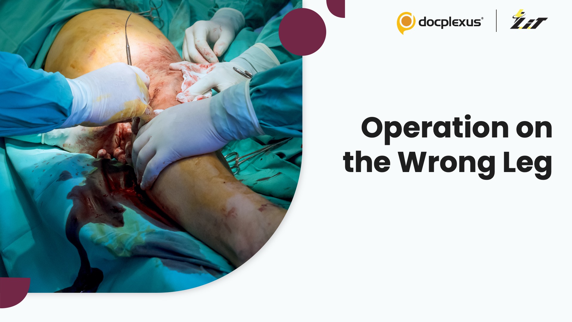 Patient Alleges Surgeon Operated on the Wrong Leg Without Consent