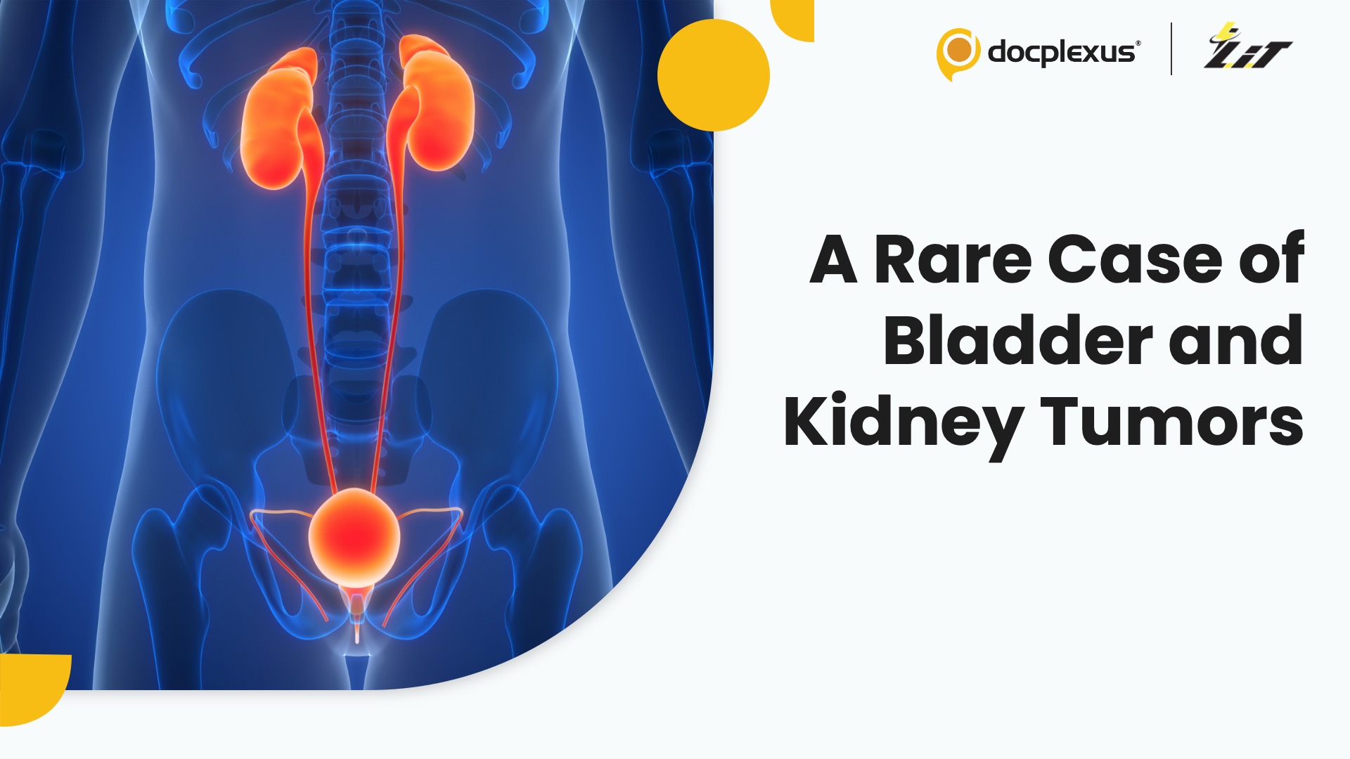 Urologist Successfully Removes Tumors in Bladder and Kidney