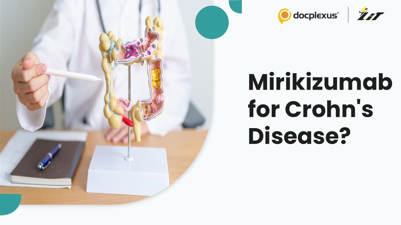 Can Mirikizumab Effectively Treat Crohn's Disease?