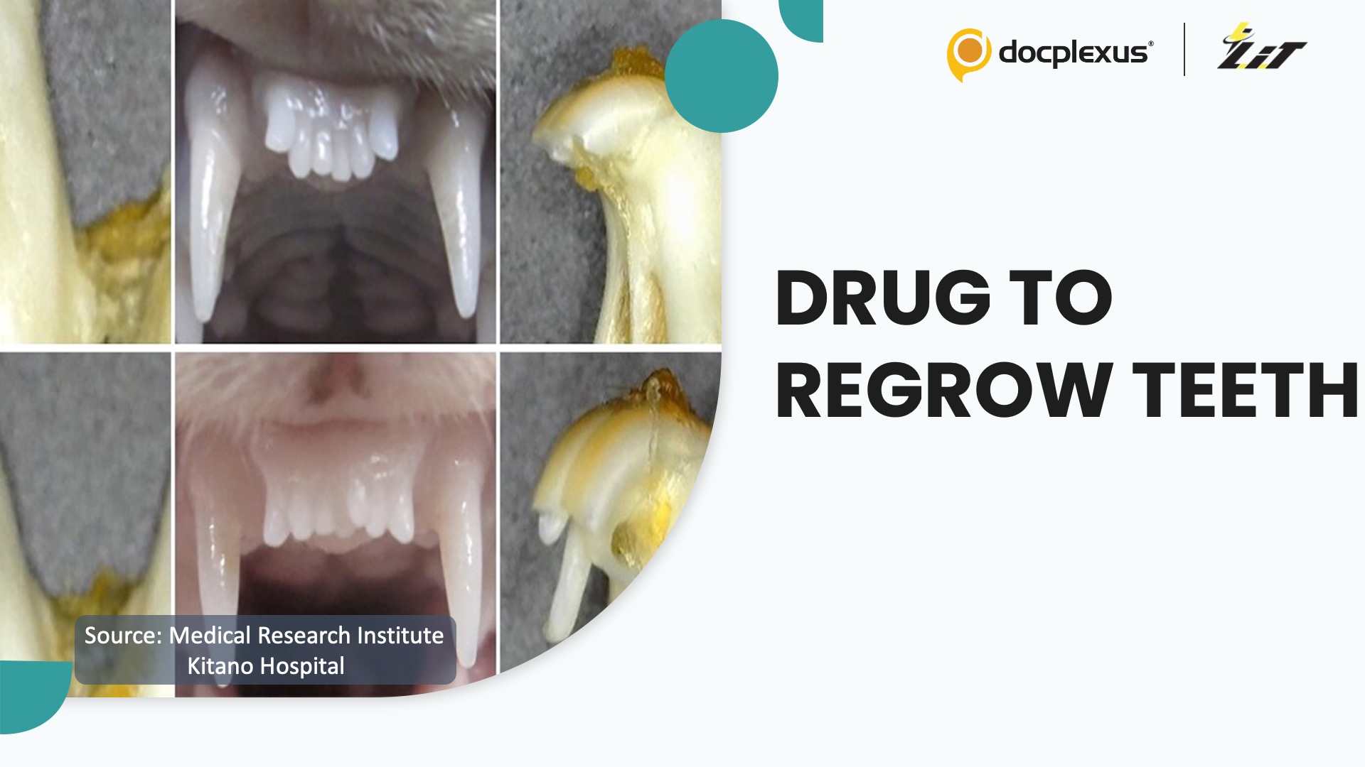 Japanese Researchers Develop Drug to Regrow Teeth