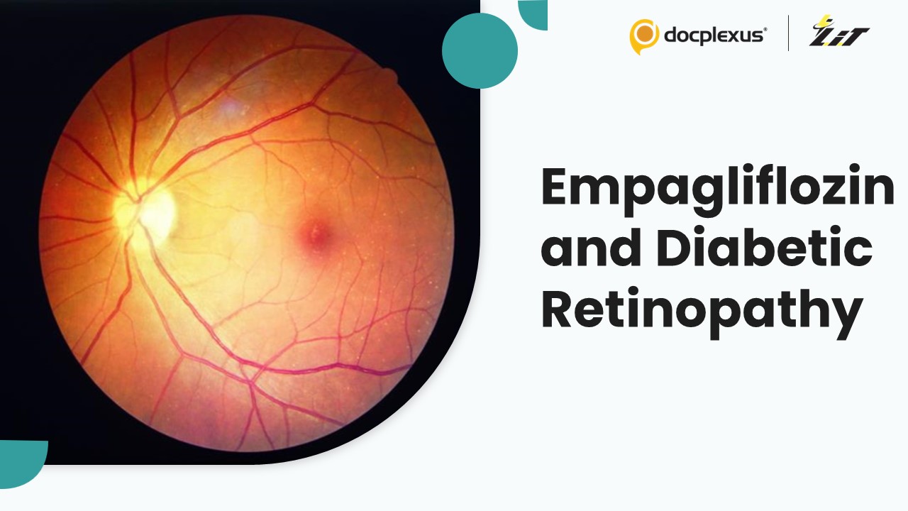 Can Empagliflozin Reduce the Risk of Diabetic Retinopathy Progression?